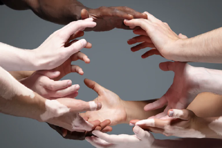 Diversidad e inclusión, desafíos para el líder y su equipo