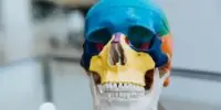 Startup fabrica el implante craneal por tecnología de impresión 3D